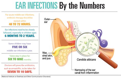 Curing an Ear Infection - HealthLinks SC