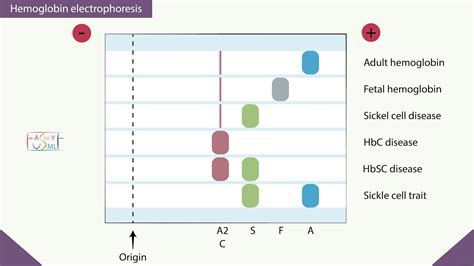 Hemoglobin Electrophoresis Wikipedia, 43% OFF