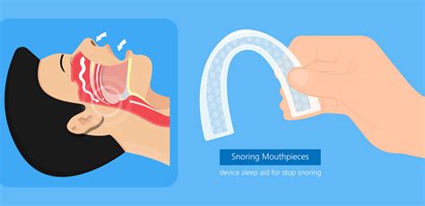 Mouth Guard for Snoring: A Complete Guide