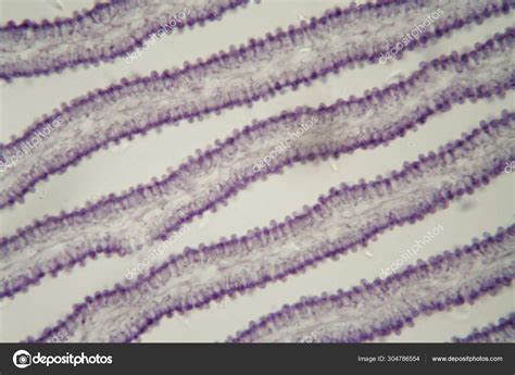 Coprinus mushroom under the microscope Stock Photo by ©ChWeiss 304786554