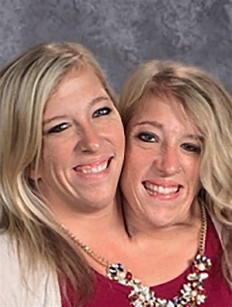 Abby and Brittany Hensel — See What the Famous Conjoined Twins Look ...