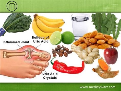 Foods to be avoided in high uric acid