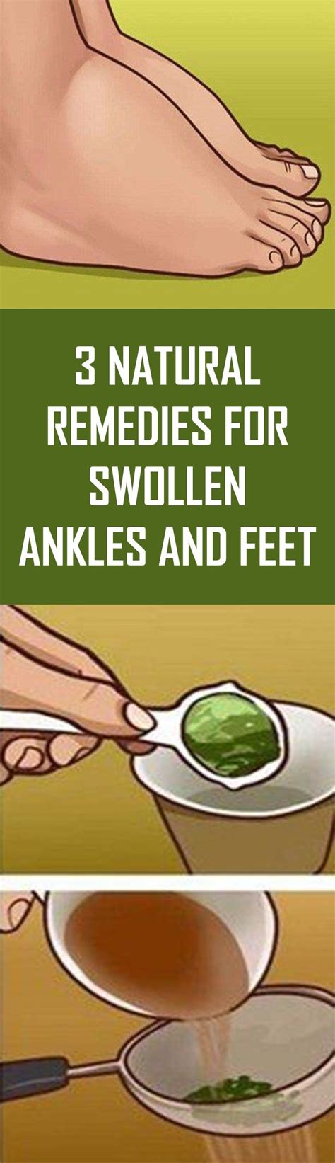 3 Natural Remedies For Swollen Ankles and Feet, #body #Care #feetcare # ...