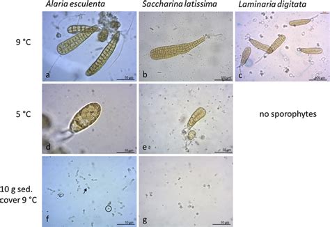 Microscope pictures of spores and juvenile sporophytes of A. esculenta ...