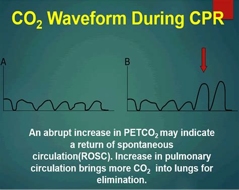 low end tidal co2 during cpr - Ensure The Effective History Image Library