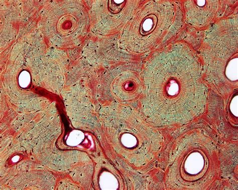 File:Bone histology 003.jpg - Embryology