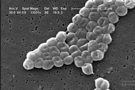 Coccobacilli (Gram Negative Bacteria) - Laboratoryinfo.com