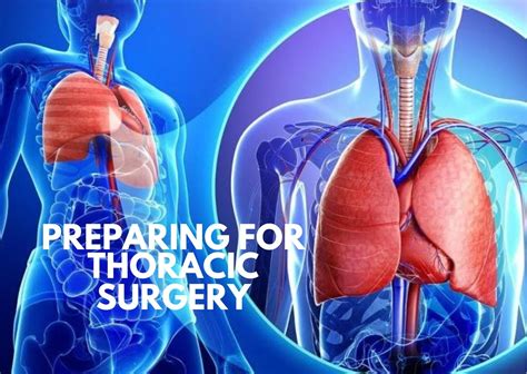 Preparing for Thoracic Surgery: What you need to know! – The Operating ...