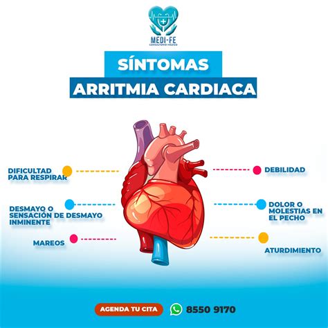 Arritmia Cardiaca