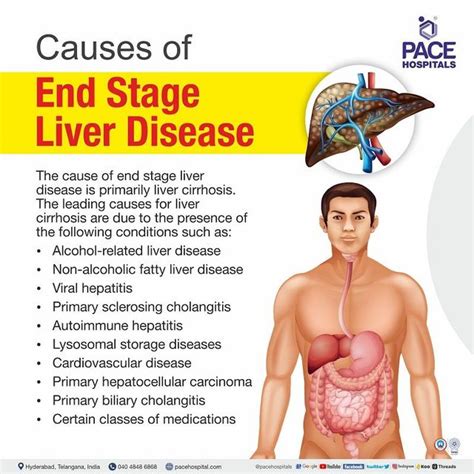 Liver Cirrhosis Symptoms Skin