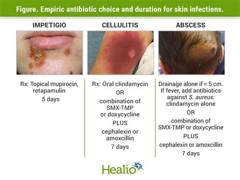 4 Which Antibiotic Would Work Best to Treat Staph Aureus - Cedric-has ...