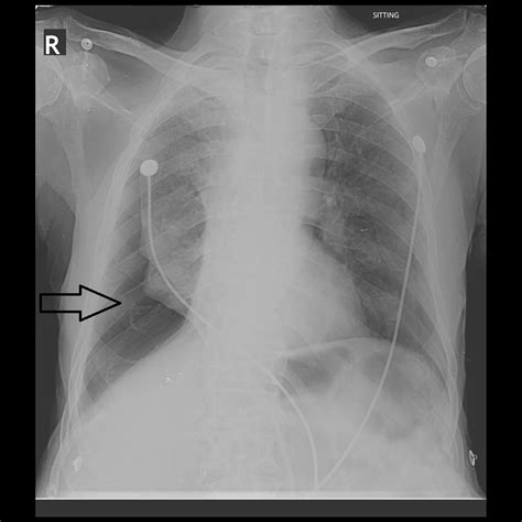 Cureus | Concordance Between Resident and Attending Radiologist in ...