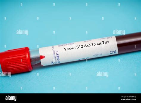 Vitamin B12 And Folate Test These Test measure the levels of these ...