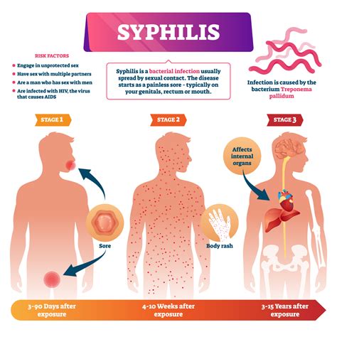 Testing for Syphillis | Community Care Resources of Florida