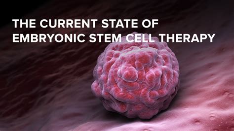 Stem Cell Therapy