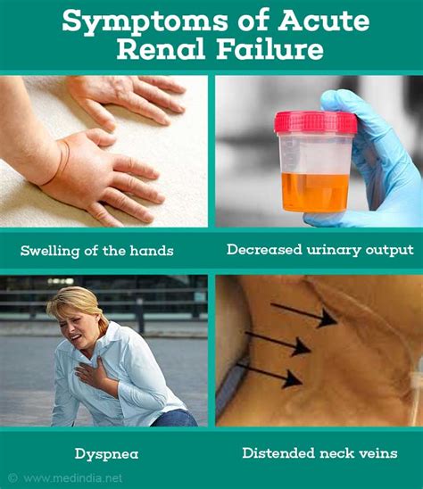 Acute Renal (Kidney) Failure- Causes, Symptoms, Diagnosis, Treatment ...