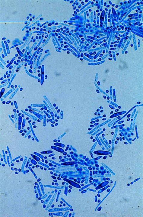 trichosporon / fungi print inspiration Bacteria Under Microscope ...