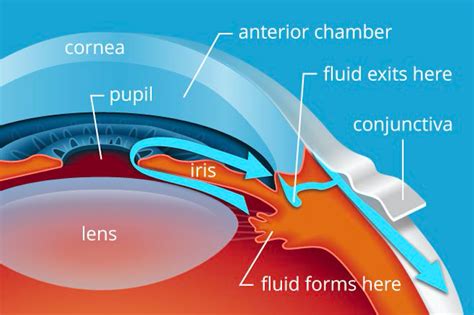 Non-Traumatic Monocular Vision Loss – Core EM