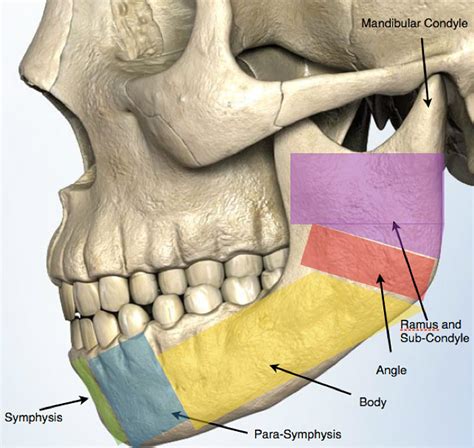 Jaw Fracture - Facial Trauma