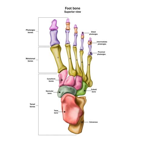 Foot Fracture (Surgery) | Pediatric Foot & Ankle Specialists