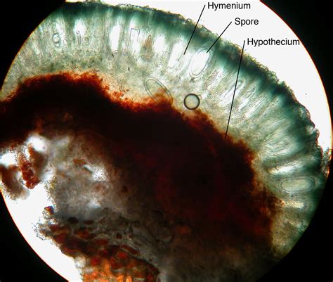 Lichen Cross Section