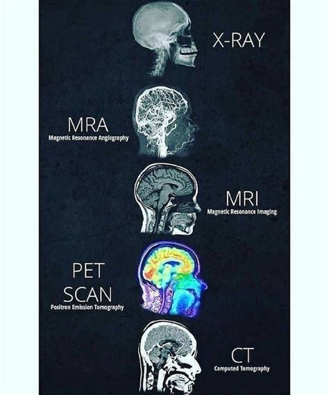 Different methods of radiology imaging!! - MEDizzy