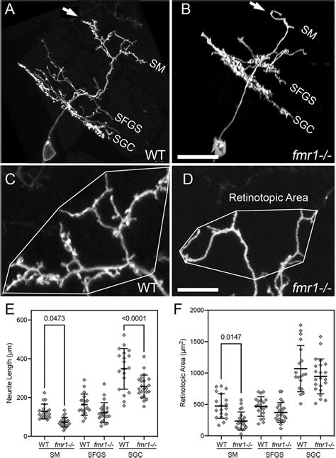 fmr1 mutants exhibit defects in PyrN dendrite development. (A,B ...