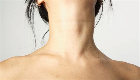 Thyroid-neck-rash-treatment - Trending 582cqw