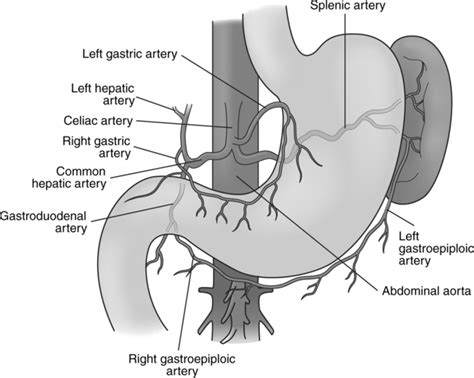 Abdominal Aortography and Genitourinary System Procedures | Radiology Key