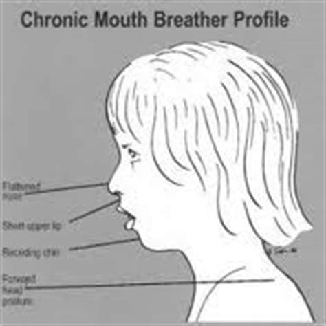 Mouth Breathing Diagnosis & Treatment Cork | O Connor Dental Health