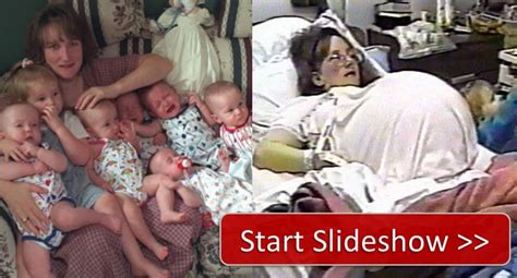 World's First Surviving Septuplets - Fertility Treatment's Miracle ...