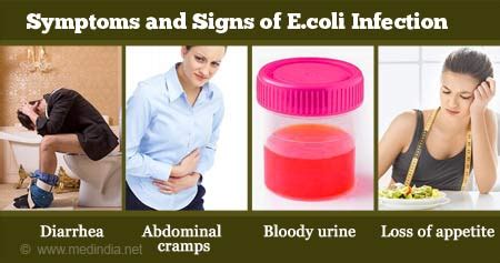 Coli: Symptoms, Diagnosis, And Treatment, 50% OFF