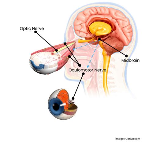 Eye-movements and Kinesiology for clearing fixated stress, trauma, and ...