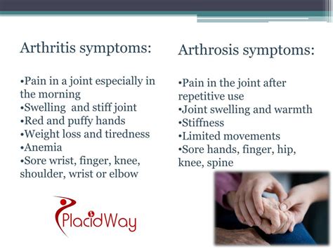 PPT - Arthritis vs Arthrosis - Know the Difference PowerPoint ...