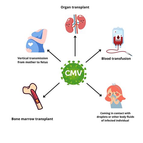 A Review of Sensorineural Hearing Loss in Congenital Cytomegalovirus ...