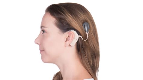 Cochlear Implants - AOPA