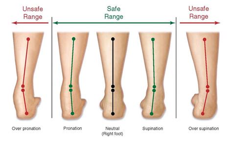 Do you know what’s your pronation type? | JustRunLah!