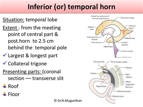 Lateral ventricle of Brain. By Dr.N.Mugunthan.M.S