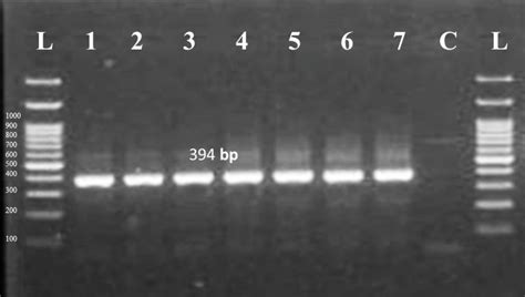 Agarose gel electrophoresis 1.5% (1X TBE). Lane L represent 100bp size ...