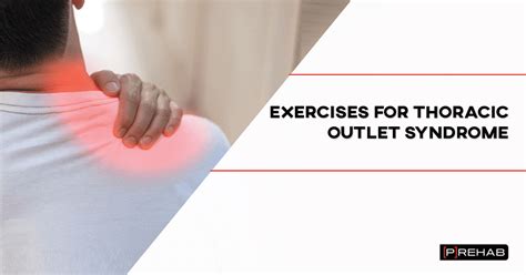 7 Exercises for Thoracic Outlet Syndrome | The Prehab Guys