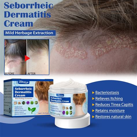 Multi-purpose Dermatitis & Scalp Treatment Cream in Nepal at NPR 5999 ...