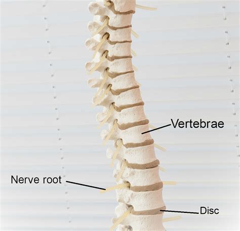 Anemone žuvis replika sušaudytas l4 s1 spine Prielaida Braškių kriaušė