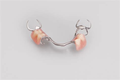 Metal Partial Dentures - Dandy