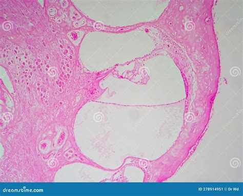 Inner Ear Unveiled: Guinea Pig Cochlea S Organ of Corti at 100x Stock ...