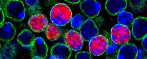 Scientists Have Discovered a New Stem Cell That Could Heal Brain Damage ...