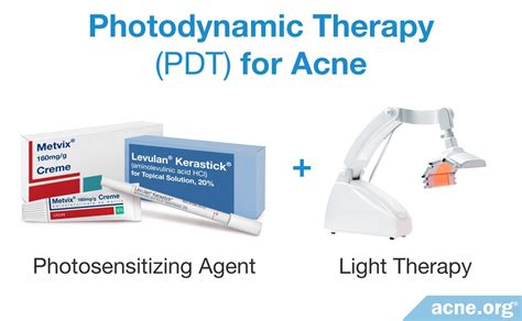 Does Photodynamic Therapy Work for Acne? - Acne.org