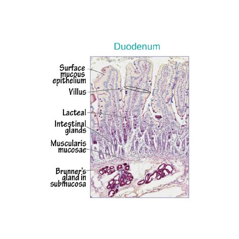 Histology Glossary: Histology - Small & Large Intestine | ditki medical ...