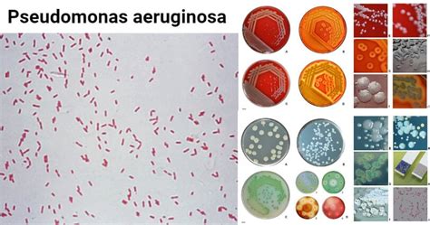 Pseudomonas Aeruginosa Gram Stain