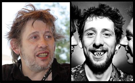 Pogues' Shane MacGowan to fix his teeth for Hollywood career