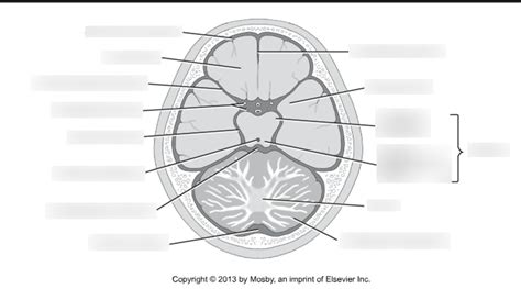 Basal Cisterns Anatomy